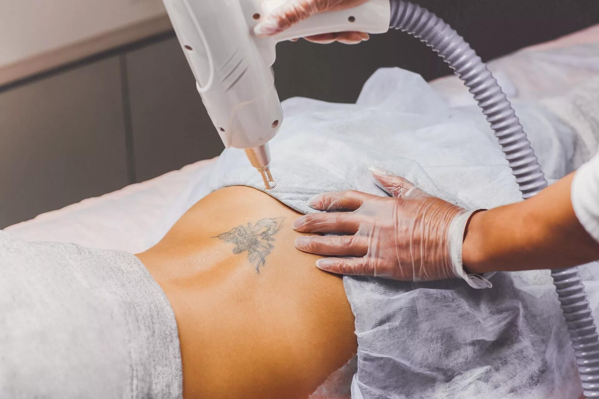 How to use a laser tattoo removal machine?